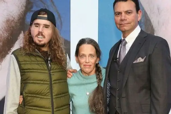 Face transplant